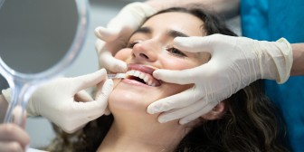 Nahansicht einer Patientin, bei der die Lippen angehoben werden, um die Zahnfärbung abzugleichen